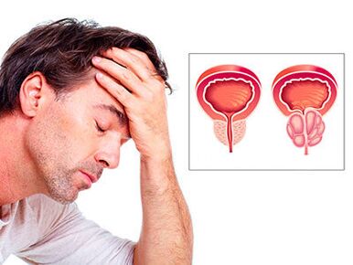 Die Symptome einer Prostatitis machen einem Mann Sorgen